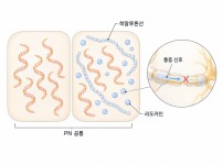 리쥬란HB plus는 PN을 공통으로 유지하면서 리도카인을 더해 통증 신호 전달을 줄인 선택지입니다 - 광주리쥬란 | 미미썸의원 광주광천점