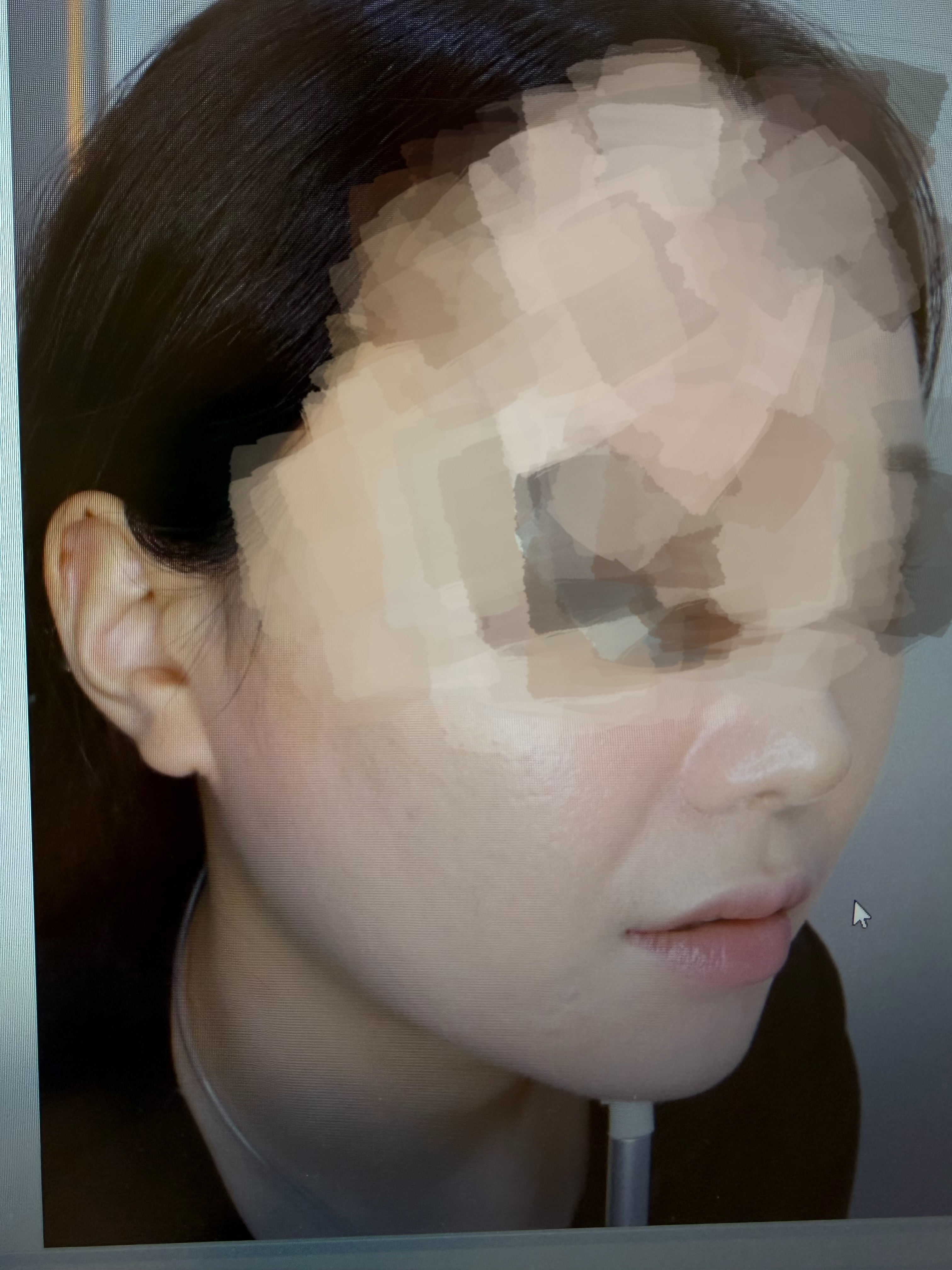 팔자 지우개 완벽 없애버린 찐찐 내돈내산 후기